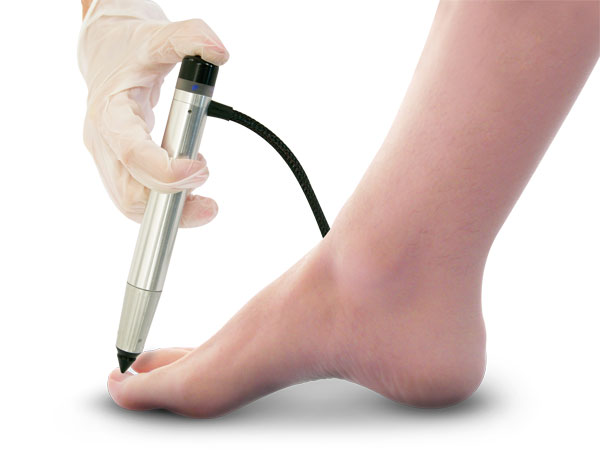 Fungal Toe Nails
