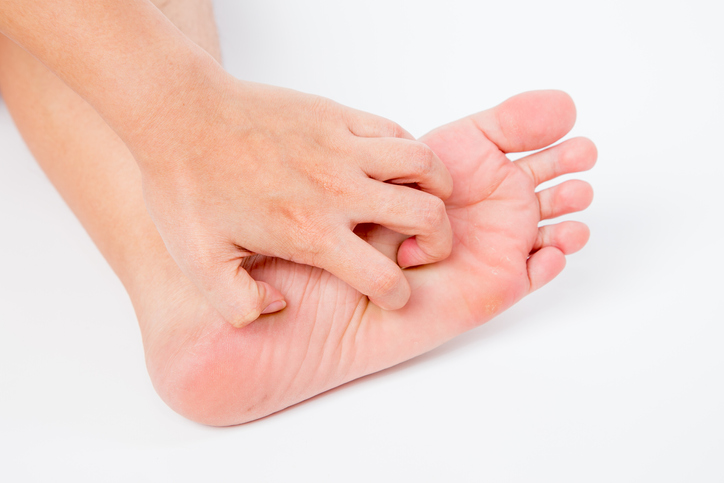 Athlete’s Foot