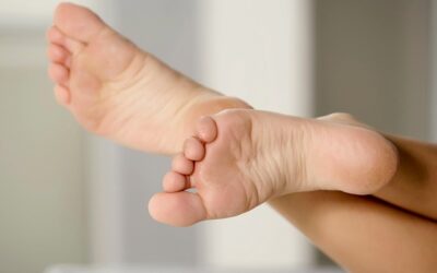 Plantar Fasciitis