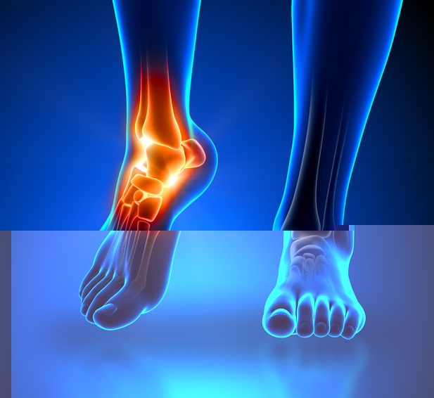 Ankles pain